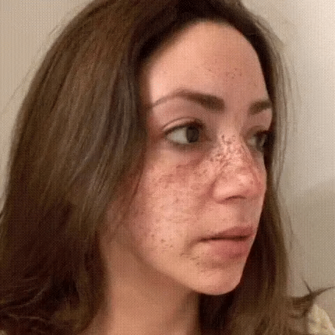 ✨Eliminador rápido de manchas oscuras ™️ Suero facial corrector de melanina