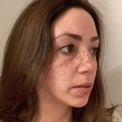 ✨Eliminador rápido de manchas oscuras ™️ Suero facial corrector de melanina
