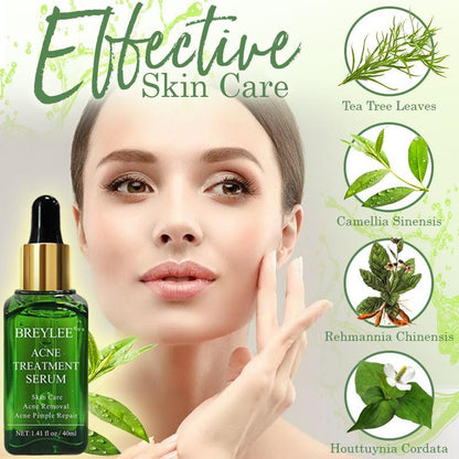Mascarilla Esmalte facial Breylee ®️ Único en el mercado, elimina machas, acné, espinillas, puntos negros y cierra poros