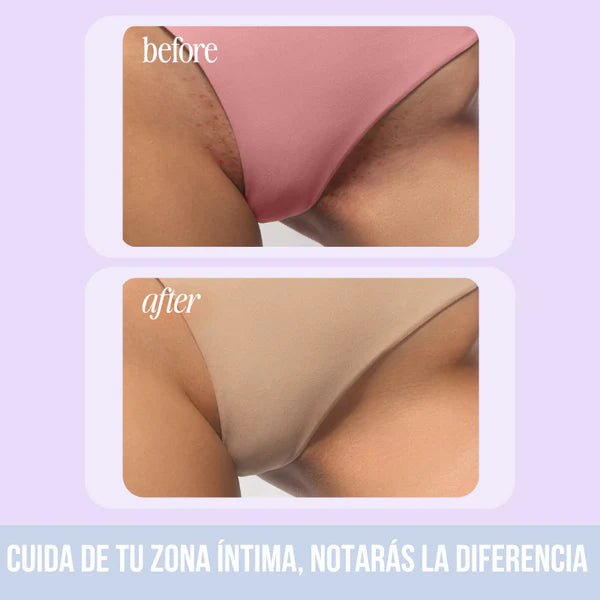 Truly Aceite zona V 💗 N°1 en Colombia (100ml)