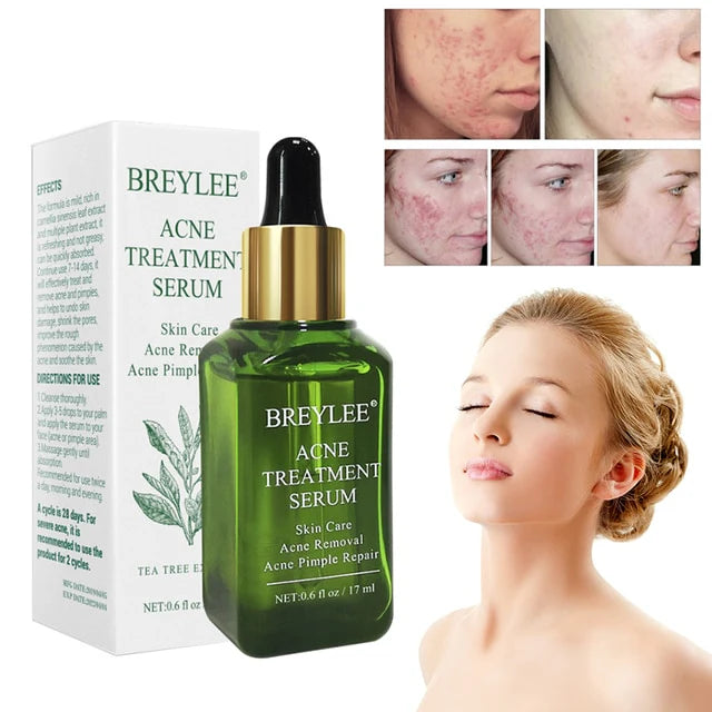 Mascarilla Esmalte facial Breylee ®️ Único en el mercado, elimina machas, acné, espinillas, puntos negros y cierra poros